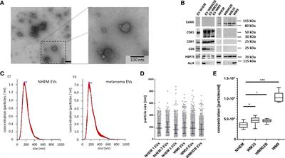 Comprehensive Analyses of miRNAs Revealed miR-92b-3p, miR-182-5p and miR-183-5p as Potential Novel Biomarkers in Melanoma-Derived Extracellular Vesicles